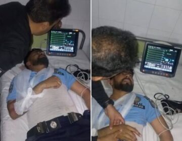 اسلام آباد: آندھی کے دوران درخت گرنے سے پولیس اہلکار زخمی